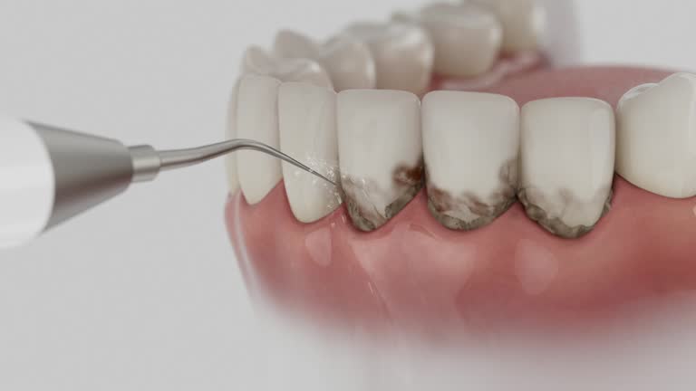 Reliable Dental Implants contractor in Secaucus, NJ by Smile Center Dentistry
